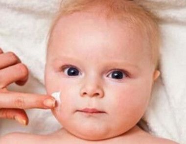 冬季婴儿脸颊发红怎么改善 如何改善冬季婴儿脸颊发红