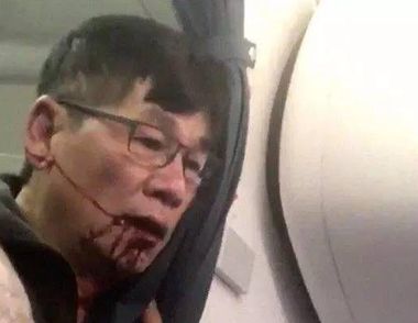 美联航暴力拖曳亚裔乘客下飞机  ​ 乘坐飞机要注意什么