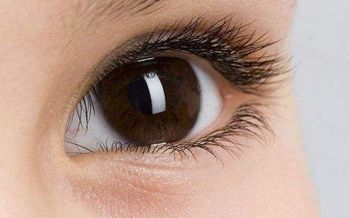 割双眼皮后需要注意什么 双眼皮术后的注意事项