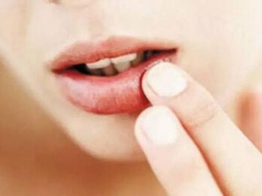 嘴唇周围皮肤干燥缺水起皮怎么办？