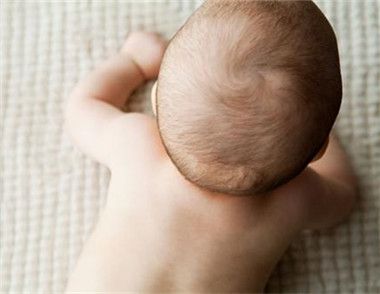 婴儿头上的乳痂如何去除