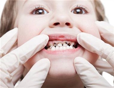 小孩子蛀牙疼如何快速止疼