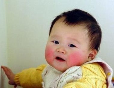 ​为什么冬季孩子脸上皮肤会皲裂 孩子脸部皮肤皲裂了怎么办