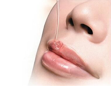 冬季唇部应该怎么护理 唇部护理有什么注意事项