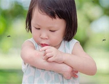 如何预防宝宝被蚊子叮咬 宝宝被蚊子咬了怎么止痒消肿