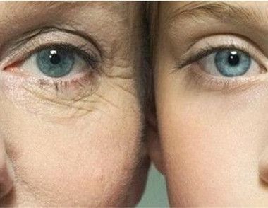 怎么预防颈纹和眼纹 预防颈纹和眼纹的方法