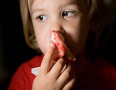 吃荔枝会流鼻血吗 如何预防流鼻血