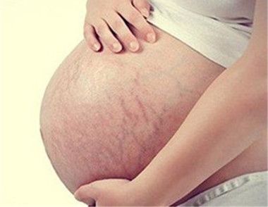 孕期为什么会长妊娠纹 孕期如何预防妊娠纹的出现