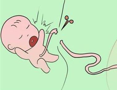 ​新生儿破伤风是什么 ​新生儿破伤风的症状是什么