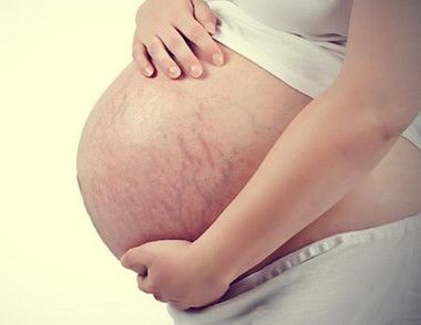 妊娠纹什么时候开始出现 为什么孕妇妊娠妏会痒