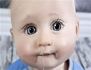 宝宝感冒流鼻涕怎么办 宝宝感冒流鼻涕能吃鸡蛋吗