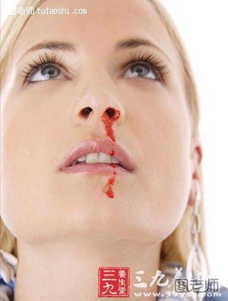 鼻子干燥出血的各种原因分析
