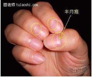 指甲上的半月痕你懂多少？指甲半月痕与健康吉凶