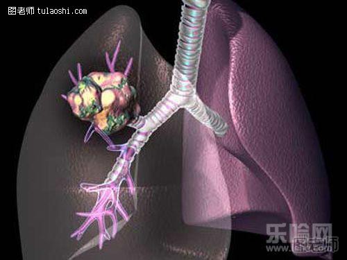 肺癌会遗传吗