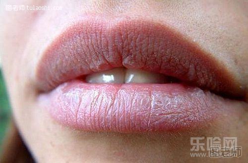 嘴唇发紫是什么原因引起的