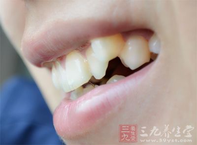 口腔学专家最新研究认为，饭后立即刷牙有害牙齿健康