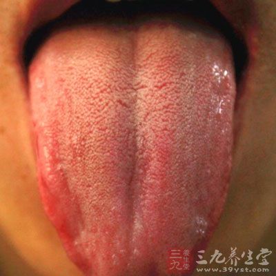 观察舌头颜色和舌苔
