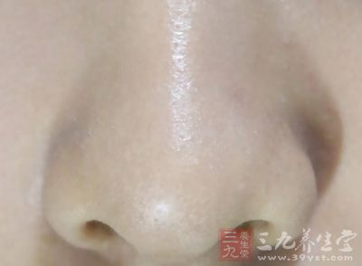 急性鼻前庭炎表现为鼻前庭处疼痛