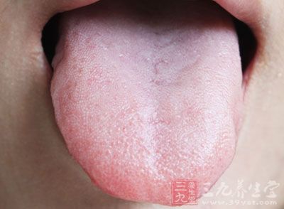 舌下腺囊肿的症状有哪些