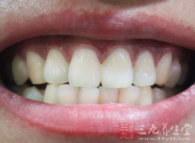 每一个人的口腔后面大牙的咬合面都是凹凸不平的