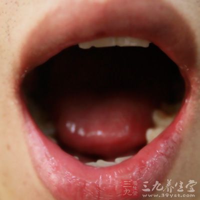 舌体胖，舌苔腻或厚腻，刮除后移时又渐增厚