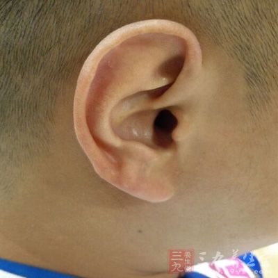 这是耳部的疾病