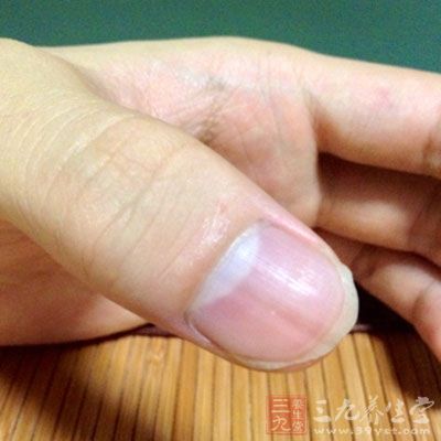 指甲上的竖纹跟人体的健康是有关系的