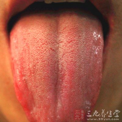 舌头发红，舌苔发黄，舌质也是红色的