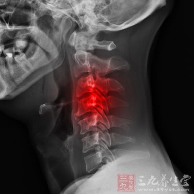 X线平片在脊柱疾病的临床诊断及治疗的指导上有特殊意义