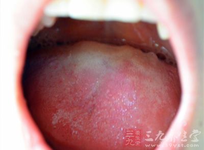 口腔本身的病变，舌、牙龈、牙周病变