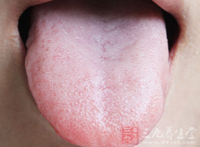 表现为舌部粘膜呈红色或紫红色圆形斑块