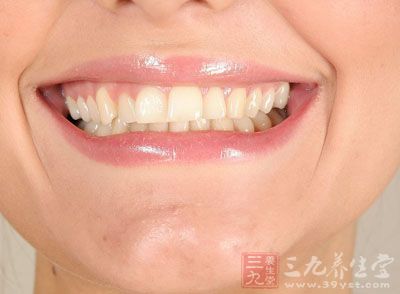 牙结石是附着在牙齿上的异物硬块，如水壶里的水锈，所以又俗称牙锈