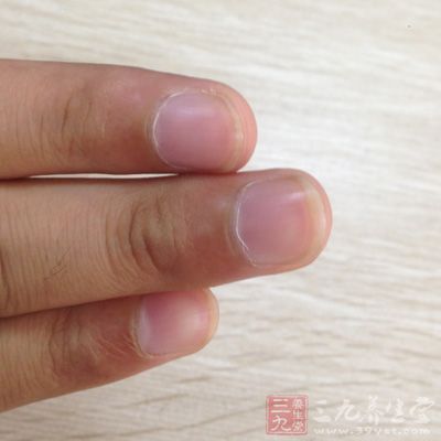 指甲的表面平整光滑是健康的表示