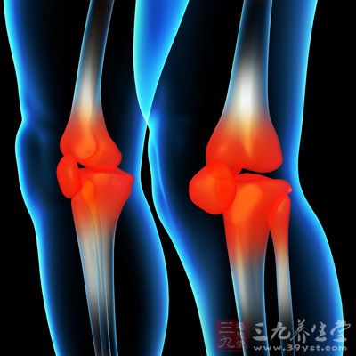 膝盖积水是一种多发性疾病，其发病部位主要在膝关节