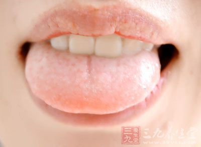 舌头的颜色能反映出一个人的健康状况
