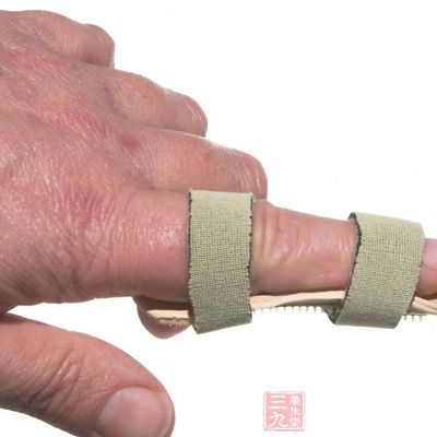 一个或多个手指红肿发痛，手指末端关节发生骨膨大，骨膨大也可发生在近端指关节