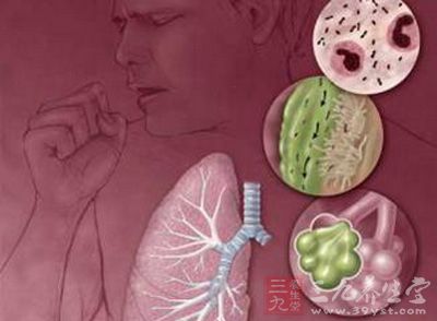 肺炎症状咳嗽，痰盛，发烧，气喘鼻煽，无汗，舌苔薄白，脉浮数