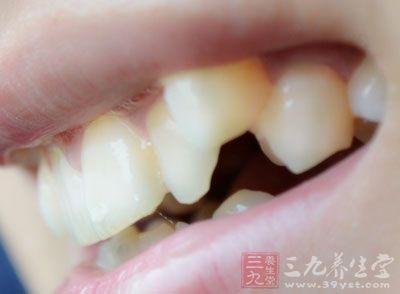 牙周炎是指发生在牙齿支持组织的慢性、非特异性、感染性炎症