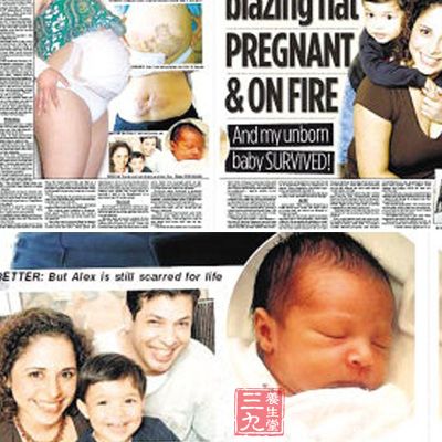 英国一怀胎7月孕妇火灾中跳楼后奇迹生子