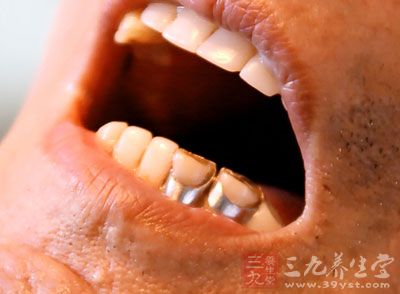 少量、均匀的牙龈退缩一般无症状，不需处理