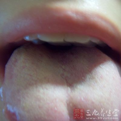 舌苔厚黄是身体不健康的一个症状