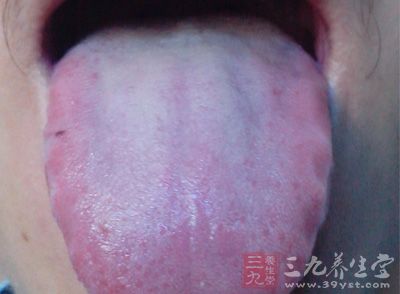 舌苔厚黄是什么原因