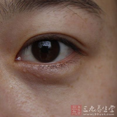干眼症也是一种能够引起眼睛痒的疾病