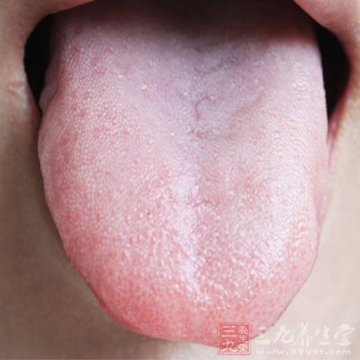 可有唇舌麻木、咽部及用食道发痒、喉部阻塞感