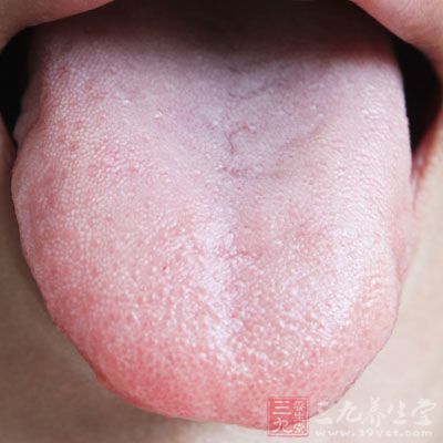 健康的舌苔应该是在淡红色的舌头上有一层薄而白