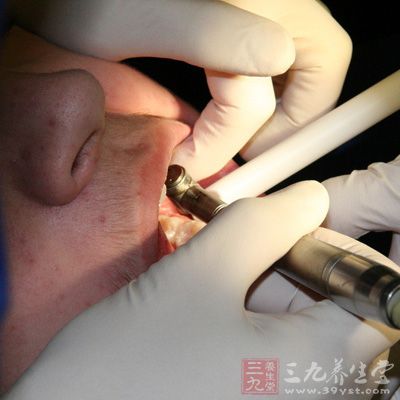 智齿萌出年龄，如果发现牙位不正或不萌出，有经常发炎，应请口腔科医生检查，早期拔除