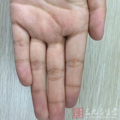 一般人在食指上面有一条横纹叫做指节纹，如果有三条指节纹的话叫做三约纹