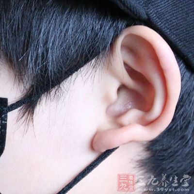招风耳，就是在正面可以明显地看到人的两耳，并且两耳远离后脑
