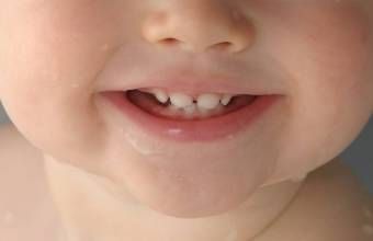 儿童蛀牙牙疼怎么办 快速止疼生活小窍门