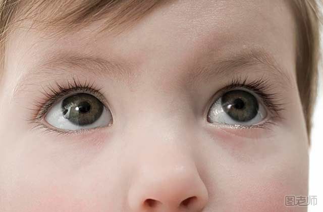 产后多天宝宝未睁眼 论罕见的无眼症